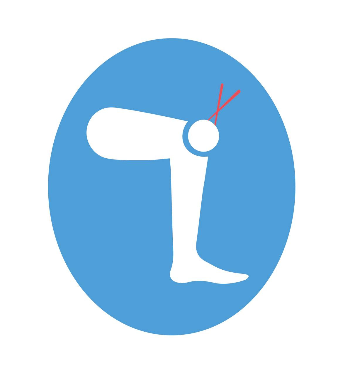 Артроскопія