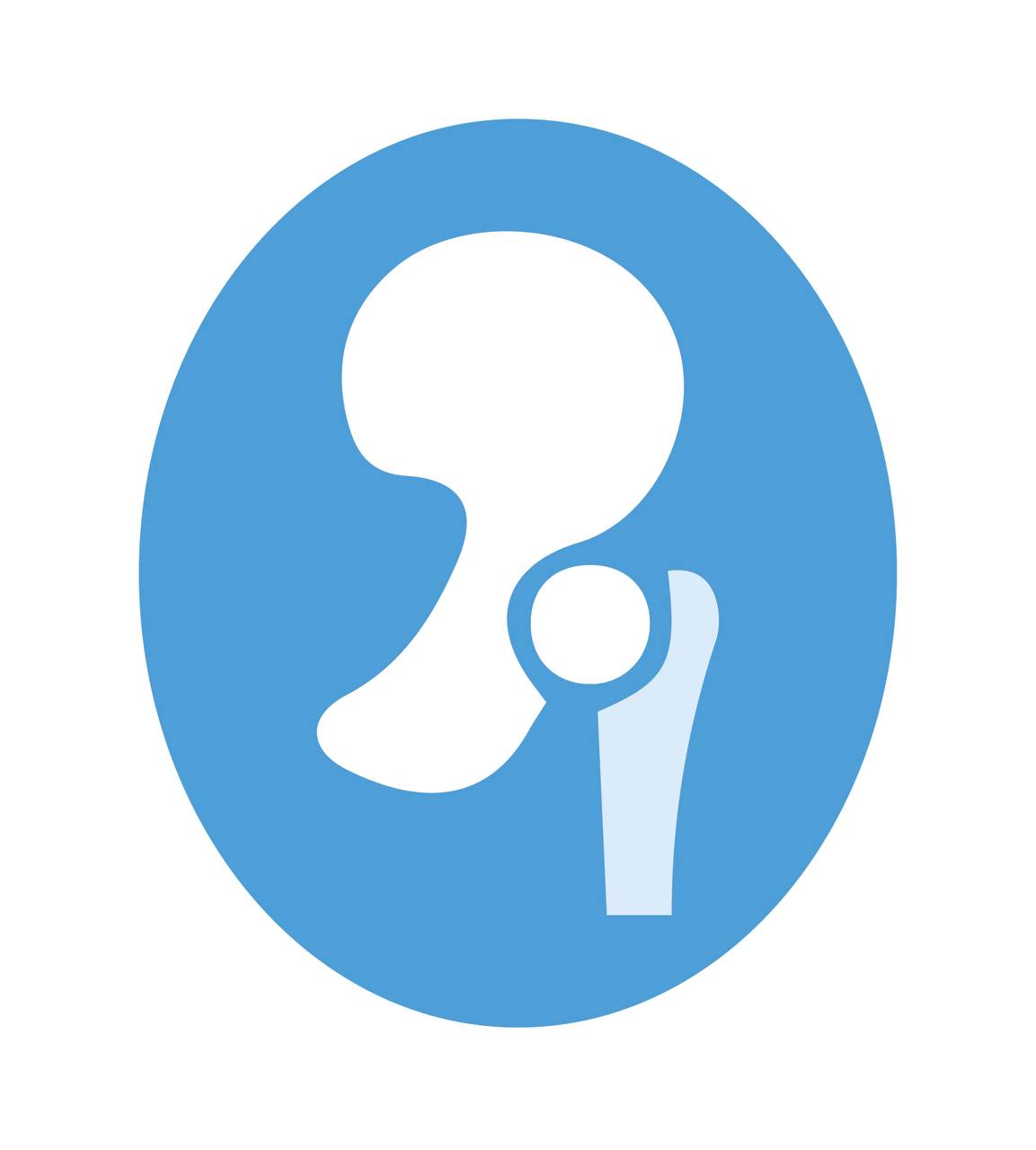 Ендопротезування