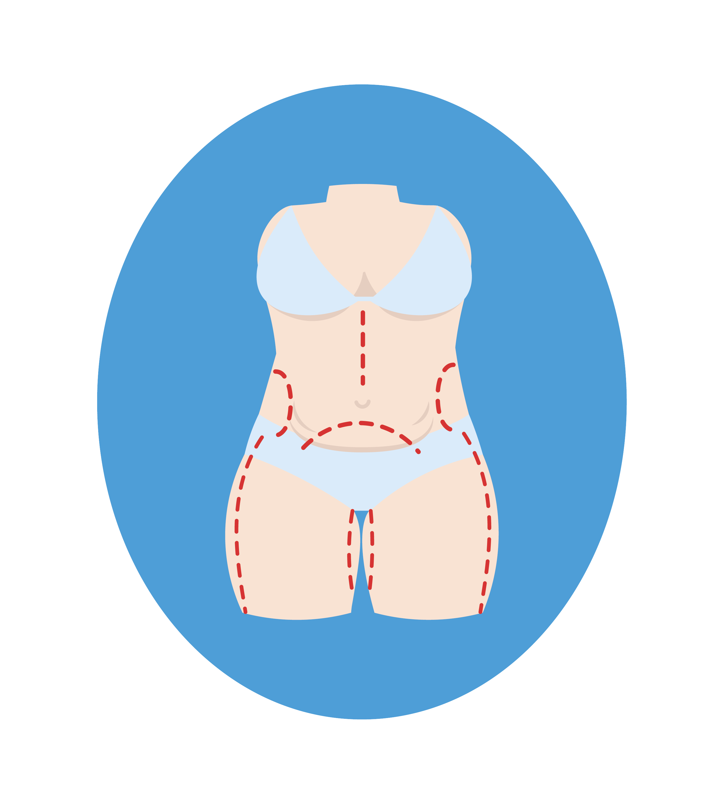 Пластична хірургія